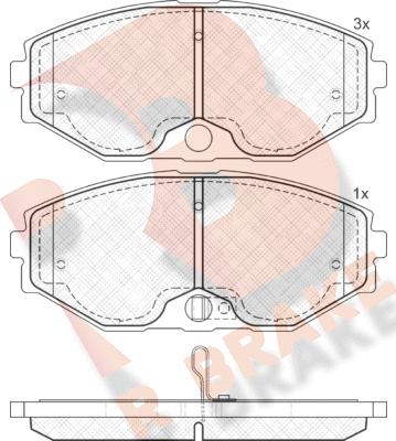 R Brake RB1569 - Bremžu uzliku kompl., Disku bremzes ps1.lv